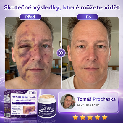 【𝑽í𝒄𝒆 𝒏𝒆ž 110 𝒕𝒊𝒔í𝒄 𝒑𝒓𝒐𝒅𝒂𝒏ý𝒄𝒉!】❤️❤️ 𝑮𝒂𝒇𝒂𝒄𝒆® 𝑲𝒓é𝒎 𝒏𝒂 𝒐𝒃𝒏𝒐𝒗𝒖 𝒑𝒐𝒌𝒐ž𝒌𝒚 𝒑𝒐 𝒎𝒐𝒅ř𝒊𝒏á𝒄𝒉 𝒂 𝒑𝒐𝒔í𝒍𝒆𝒏í 𝒑𝒐𝒌𝒐ž𝒌𝒚