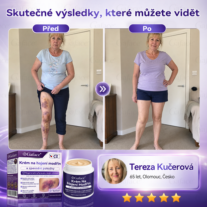 【𝑽í𝒄𝒆 𝒏𝒆ž 110 𝒕𝒊𝒔í𝒄 𝒑𝒓𝒐𝒅𝒂𝒏ý𝒄𝒉!】❤️❤️ 𝑮𝒂𝒇𝒂𝒄𝒆® 𝑲𝒓é𝒎 𝒏𝒂 𝒐𝒃𝒏𝒐𝒗𝒖 𝒑𝒐𝒌𝒐ž𝒌𝒚 𝒑𝒐 𝒎𝒐𝒅ř𝒊𝒏á𝒄𝒉 𝒂 𝒑𝒐𝒔í𝒍𝒆𝒏í 𝒑𝒐𝒌𝒐ž𝒌𝒚
