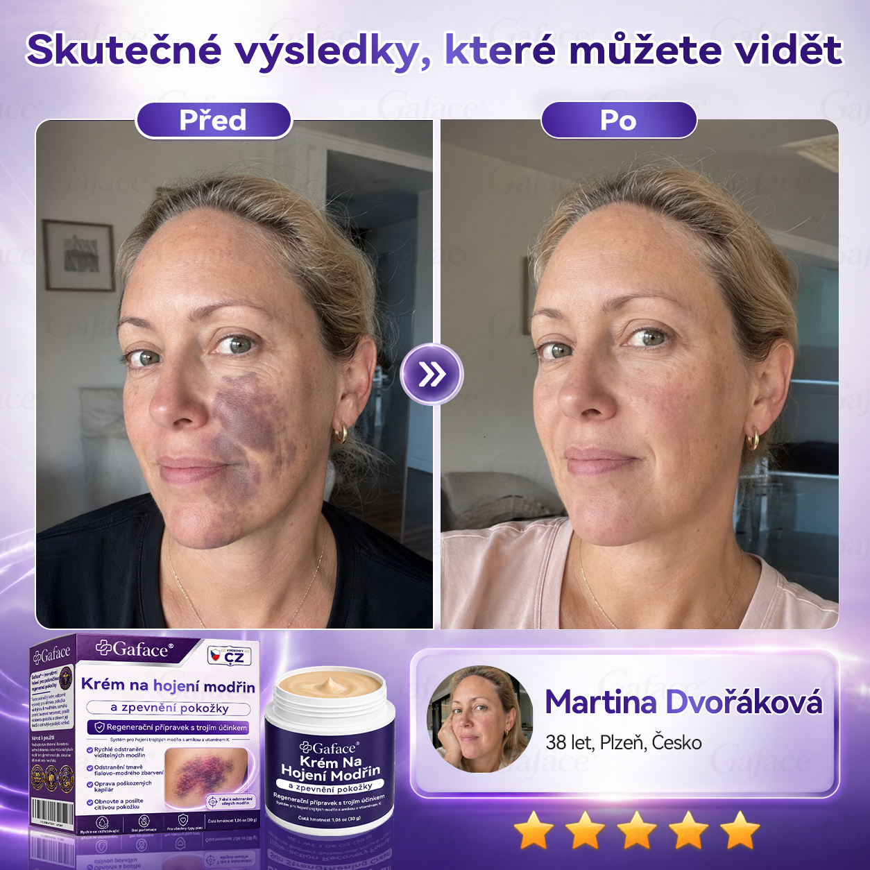 【𝑽í𝒄𝒆 𝒏𝒆ž 110 𝒕𝒊𝒔í𝒄 𝒑𝒓𝒐𝒅𝒂𝒏ý𝒄𝒉!】❤️❤️ 𝑮𝒂𝒇𝒂𝒄𝒆® 𝑲𝒓é𝒎 𝒏𝒂 𝒐𝒃𝒏𝒐𝒗𝒖 𝒑𝒐𝒌𝒐ž𝒌𝒚 𝒑𝒐 𝒎𝒐𝒅ř𝒊𝒏á𝒄𝒉 𝒂 𝒑𝒐𝒔í𝒍𝒆𝒏í 𝒑𝒐𝒌𝒐ž𝒌𝒚