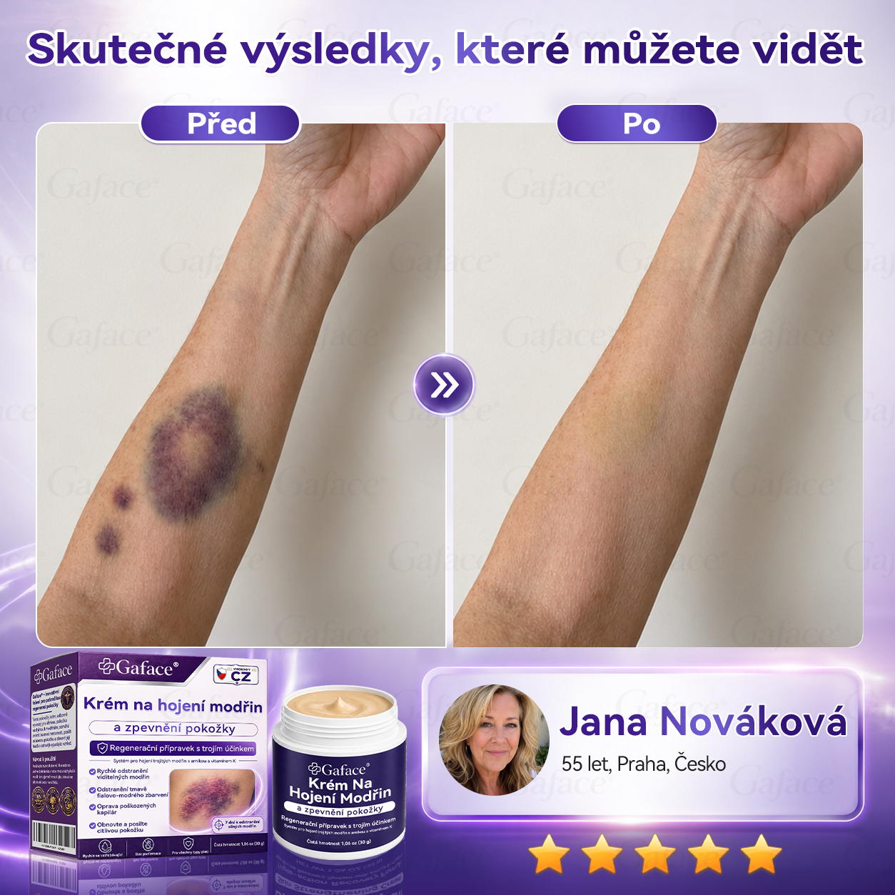 【𝑽í𝒄𝒆 𝒏𝒆ž 110 𝒕𝒊𝒔í𝒄 𝒑𝒓𝒐𝒅𝒂𝒏ý𝒄𝒉!】❤️❤️ 𝑮𝒂𝒇𝒂𝒄𝒆® 𝑲𝒓é𝒎 𝒏𝒂 𝒐𝒃𝒏𝒐𝒗𝒖 𝒑𝒐𝒌𝒐ž𝒌𝒚 𝒑𝒐 𝒎𝒐𝒅ř𝒊𝒏á𝒄𝒉 𝒂 𝒑𝒐𝒔í𝒍𝒆𝒏í 𝒑𝒐𝒌𝒐ž𝒌𝒚