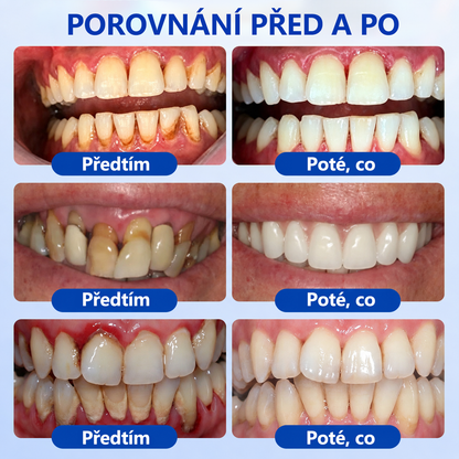 🦷🦷 𝑮𝒍𝒊𝒎𝒎𝒆𝒓𝒍𝒚® 𝑮𝒖𝒎𝑹𝒆𝒗𝒊𝒗𝒆 𝑷𝒂𝒓𝒐𝒅𝒐𝒏𝒕𝒂́𝒍𝒏𝒊́ 𝑹𝒆𝒈𝒆𝒏𝒆𝒓𝒂𝒄̌𝒏𝒊́ 𝑮𝒆𝒍