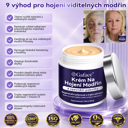 【𝑽í𝒄𝒆 𝒏𝒆ž 110 𝒕𝒊𝒔í𝒄 𝒑𝒓𝒐𝒅𝒂𝒏ý𝒄𝒉!】❤️❤️ 𝑮𝒂𝒇𝒂𝒄𝒆® 𝑲𝒓é𝒎 𝒏𝒂 𝒐𝒃𝒏𝒐𝒗𝒖 𝒑𝒐𝒌𝒐ž𝒌𝒚 𝒑𝒐 𝒎𝒐𝒅ř𝒊𝒏á𝒄𝒉 𝒂 𝒑𝒐𝒔í𝒍𝒆𝒏í 𝒑𝒐𝒌𝒐ž𝒌𝒚