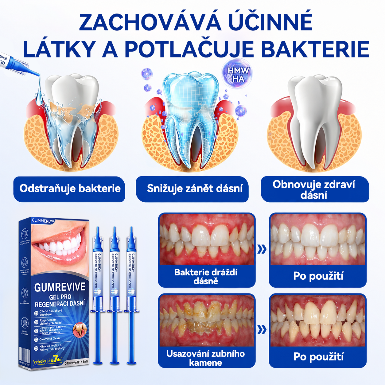 🦷🦷 𝑮𝒍𝒊𝒎𝒎𝒆𝒓𝒍𝒚® 𝑮𝒖𝒎𝑹𝒆𝒗𝒊𝒗𝒆 𝑷𝒂𝒓𝒐𝒅𝒐𝒏𝒕𝒂́𝒍𝒏𝒊́ 𝑹𝒆𝒈𝒆𝒏𝒆𝒓𝒂𝒄̌𝒏𝒊́ 𝑮𝒆𝒍
