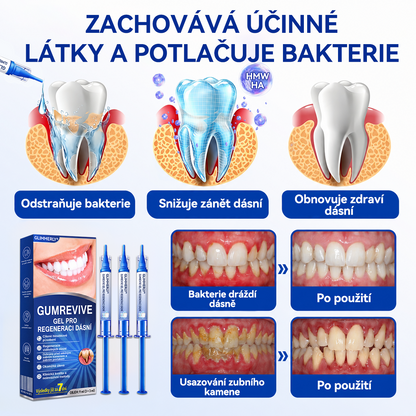 🦷🦷 𝑮𝒍𝒊𝒎𝒎𝒆𝒓𝒍𝒚® 𝑮𝒖𝒎𝑹𝒆𝒗𝒊𝒗𝒆 𝑷𝒂𝒓𝒐𝒅𝒐𝒏𝒕𝒂́𝒍𝒏𝒊́ 𝑹𝒆𝒈𝒆𝒏𝒆𝒓𝒂𝒄̌𝒏𝒊́ 𝑮𝒆𝒍