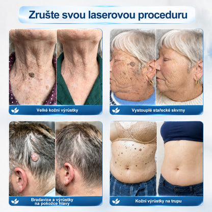 Oficiální značkový obchod |❤️❤️𝐏𝐢𝐜𝑑𝑜® 𝟩𝖽𝖾𝗻𝗻í 𝘰𝘥𝘴𝘵𝗋𝖺ň𝗈𝗏𝖺č 𝒔𝒌𝒗𝒓𝙣 𝙖 𝙥𝙞𝙜𝙢𝙚𝙣𝙩𝘰𝘷ý𝘤𝘩 𝘴𝘬𝖛𝖗𝖓 (Bezbolestný rollerball bez jizev)🎄