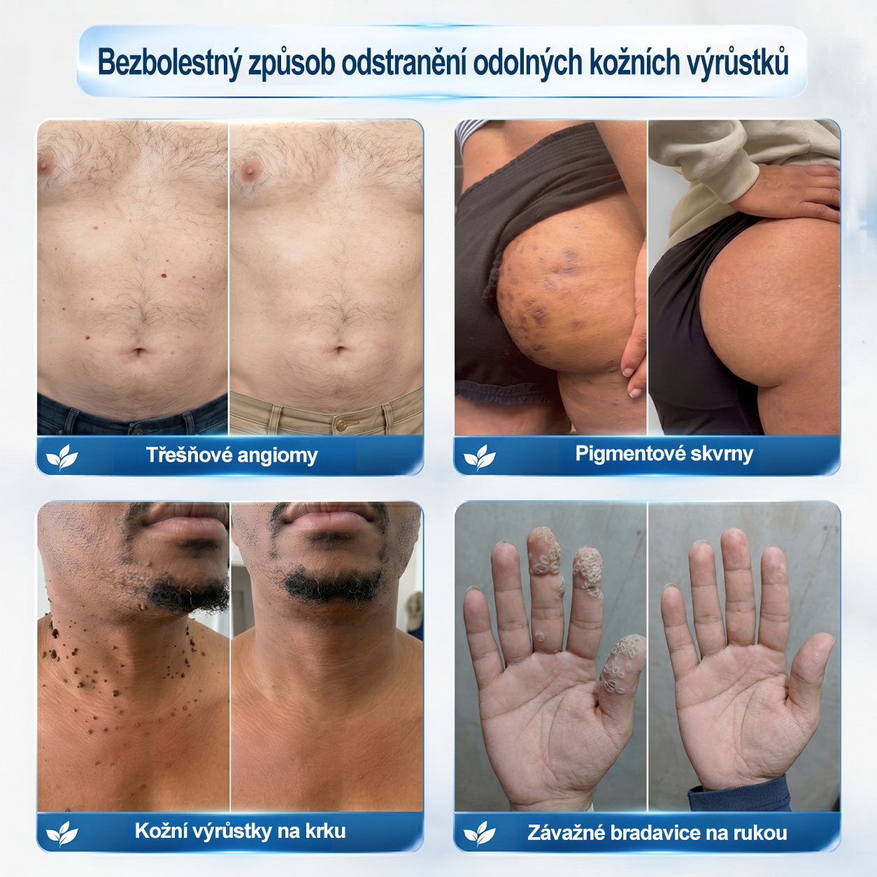 Oficiální značkový obchod |❤️❤️𝐏𝐢𝐜𝑑𝑜® 𝟩𝖽𝖾𝗻𝗻í 𝘰𝘥𝘴𝘵𝗋𝖺ň𝗈𝗏𝖺č 𝒔𝒌𝒗𝒓𝙣 𝙖 𝙥𝙞𝙜𝙢𝙚𝙣𝙩𝘰𝘷ý𝘤𝘩 𝘴𝘬𝖛𝖗𝖓 (Bezbolestný rollerball bez jizev)🎄