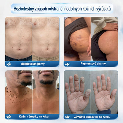 Oficiální značkový obchod |❤️❤️𝐏𝐢𝐜𝑑𝑜® 𝟩𝖽𝖾𝗻𝗻í 𝘰𝘥𝘴𝘵𝗋𝖺ň𝗈𝗏𝖺č 𝒔𝒌𝒗𝒓𝙣 𝙖 𝙥𝙞𝙜𝙢𝙚𝙣𝙩𝘰𝘷ý𝘤𝘩 𝘴𝘬𝖛𝖗𝖓 (Bezbolestný rollerball bez jizev)🎄