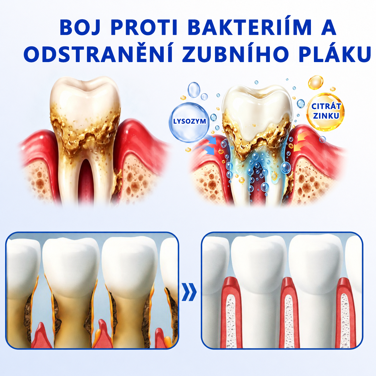 🦷🦷 𝑮𝒍𝒊𝒎𝒎𝒆𝒓𝒍𝒚® 𝑮𝒖𝒎𝑹𝒆𝒗𝒊𝒗𝒆 𝑷𝒂𝒓𝒐𝒅𝒐𝒏𝒕𝒂́𝒍𝒏𝒊́ 𝑹𝒆𝒈𝒆𝒏𝒆𝒓𝒂𝒄̌𝒏𝒊́ 𝑮𝒆𝒍