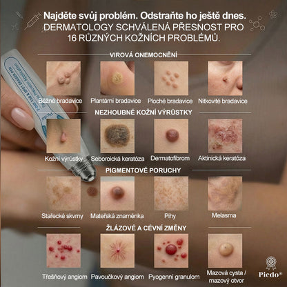 Oficiální značkový obchod |❤️❤️𝐏𝐢𝐜𝑑𝑜® 𝟩𝖽𝖾𝗻𝗻í 𝘰𝘥𝘴𝘵𝗋𝖺ň𝗈𝗏𝖺č 𝒔𝒌𝒗𝒓𝙣 𝙖 𝙥𝙞𝙜𝙢𝙚𝙣𝙩𝘰𝘷ý𝘤𝘩 𝘴𝘬𝖛𝖗𝖓 (Bezbolestný rollerball bez jizev)🎄