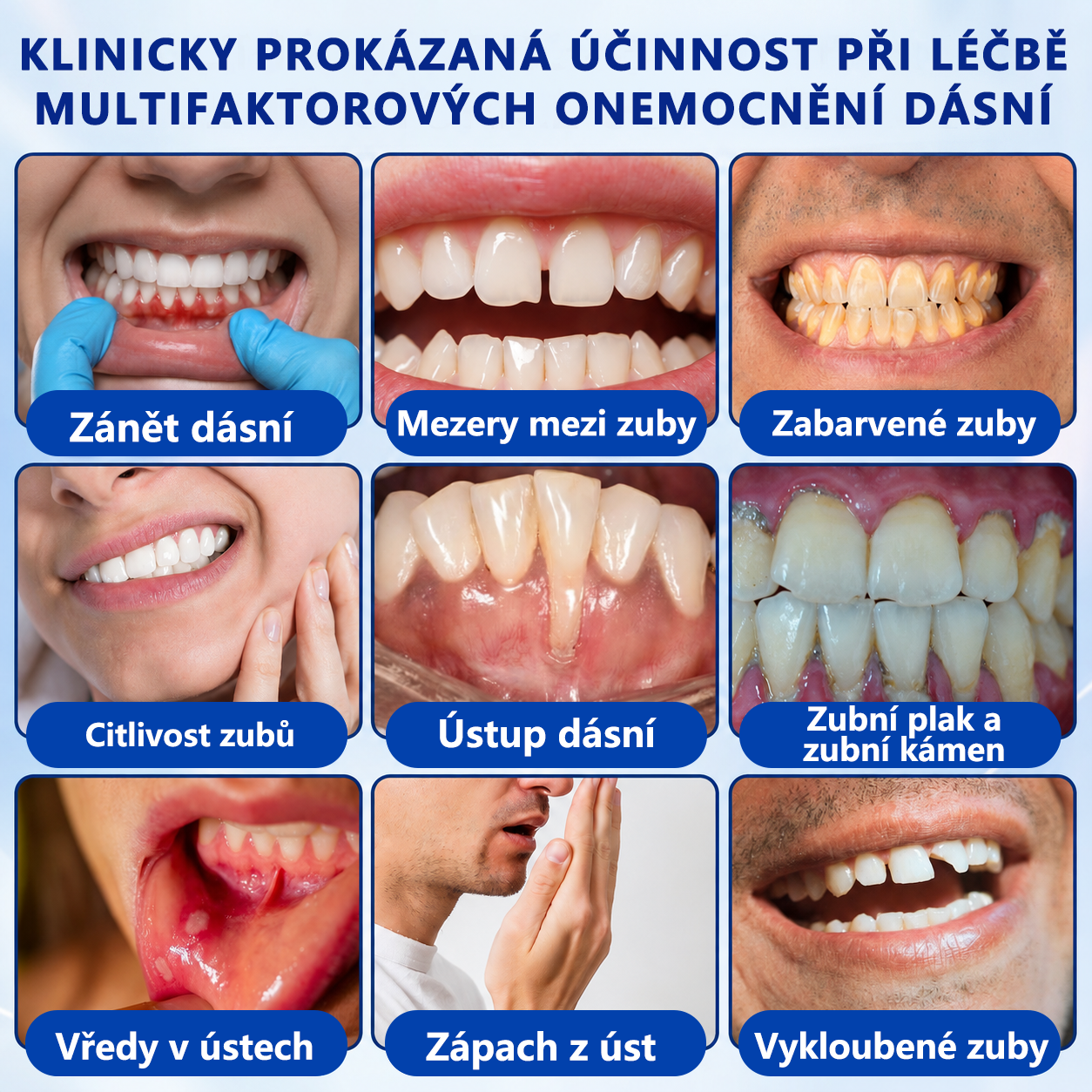 🦷🦷 𝑮𝒍𝒊𝒎𝒎𝒆𝒓𝒍𝒚® 𝑮𝒖𝒎𝑹𝒆𝒗𝒊𝒗𝒆 𝑷𝒂𝒓𝒐𝒅𝒐𝒏𝒕𝒂́𝒍𝒏𝒊́ 𝑹𝒆𝒈𝒆𝒏𝒆𝒓𝒂𝒄̌𝒏𝒊́ 𝑮𝒆𝒍
