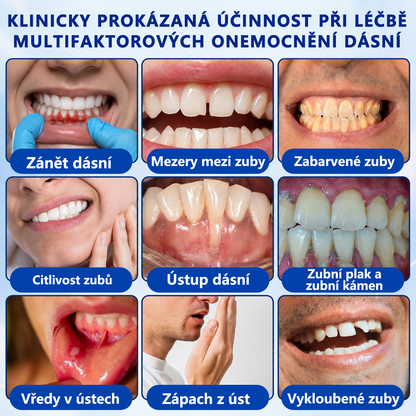 🦷🦷 𝑮𝒍𝒊𝒎𝒎𝒆𝒓𝒍𝒚® 𝑮𝒖𝒎𝑹𝒆𝒗𝒊𝒗𝒆 𝑷𝒂𝒓𝒐𝒅𝒐𝒏𝒕𝒂́𝒍𝒏𝒊́ 𝑹𝒆𝒈𝒆𝒏𝒆𝒓𝒂𝒄̌𝒏𝒊́ 𝑮𝒆𝒍
